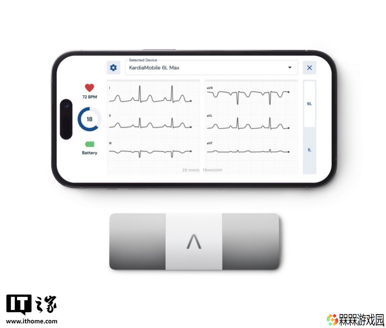 AliveCor 发布 KardiaMobile 6L Max 便携式心电图仪：六导联 ECG 监测，机身小巧能连手机